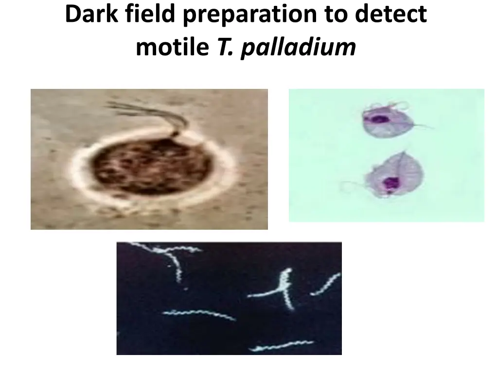 dark field preparation to detect motile