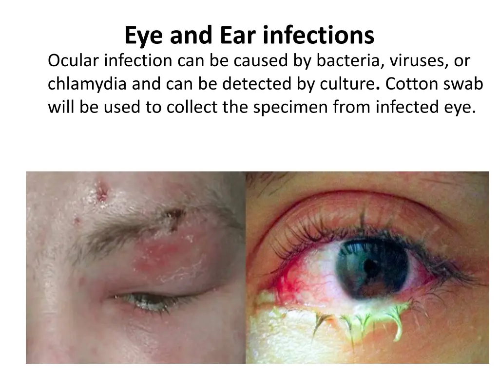 eye and ear infections ocular infection