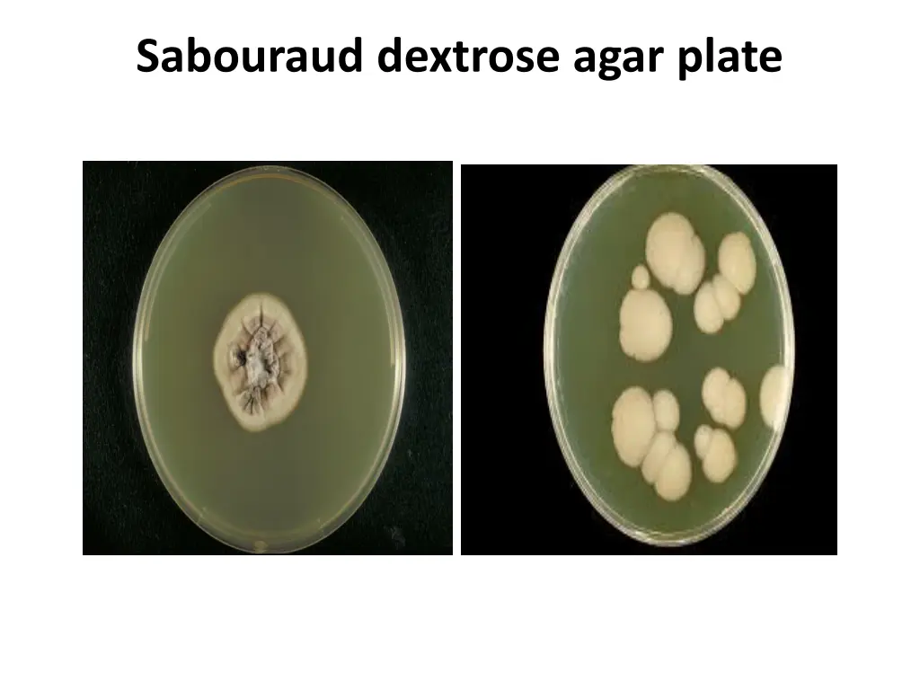 sabouraud dextrose agar plate