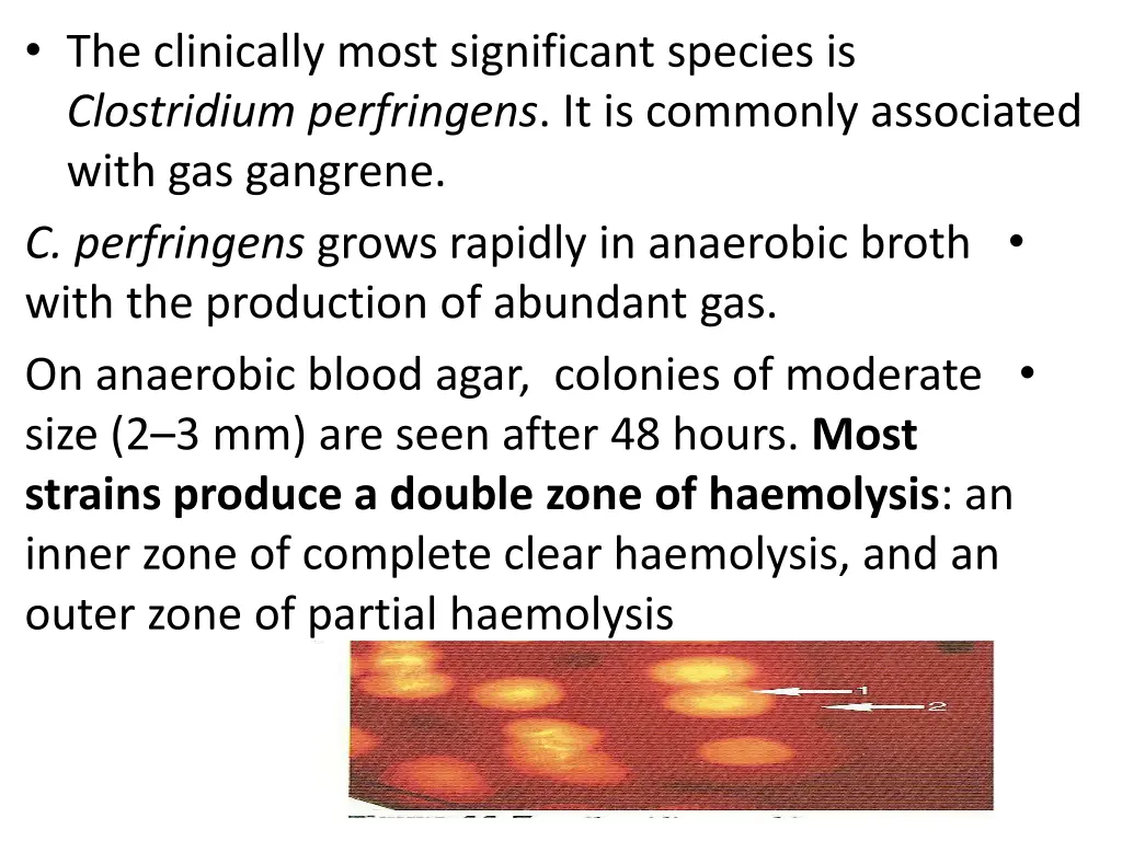 the clinically most significant species