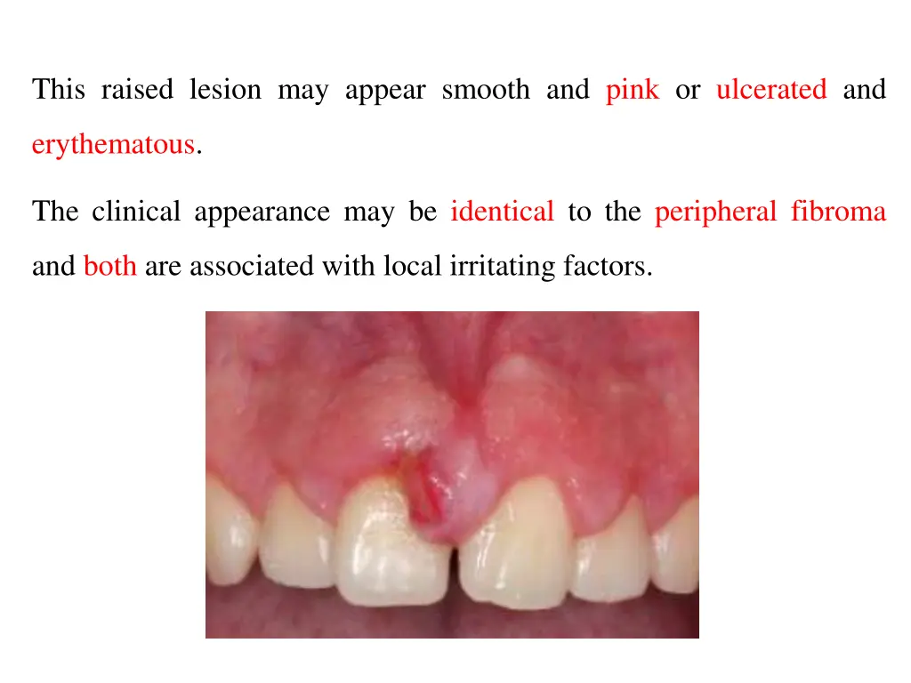 this raised lesion may appear smooth and pink