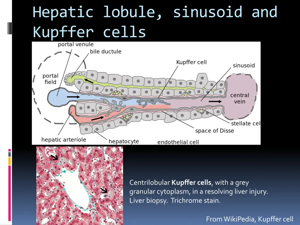 hepatic lobule sinusoid and kupffer cells