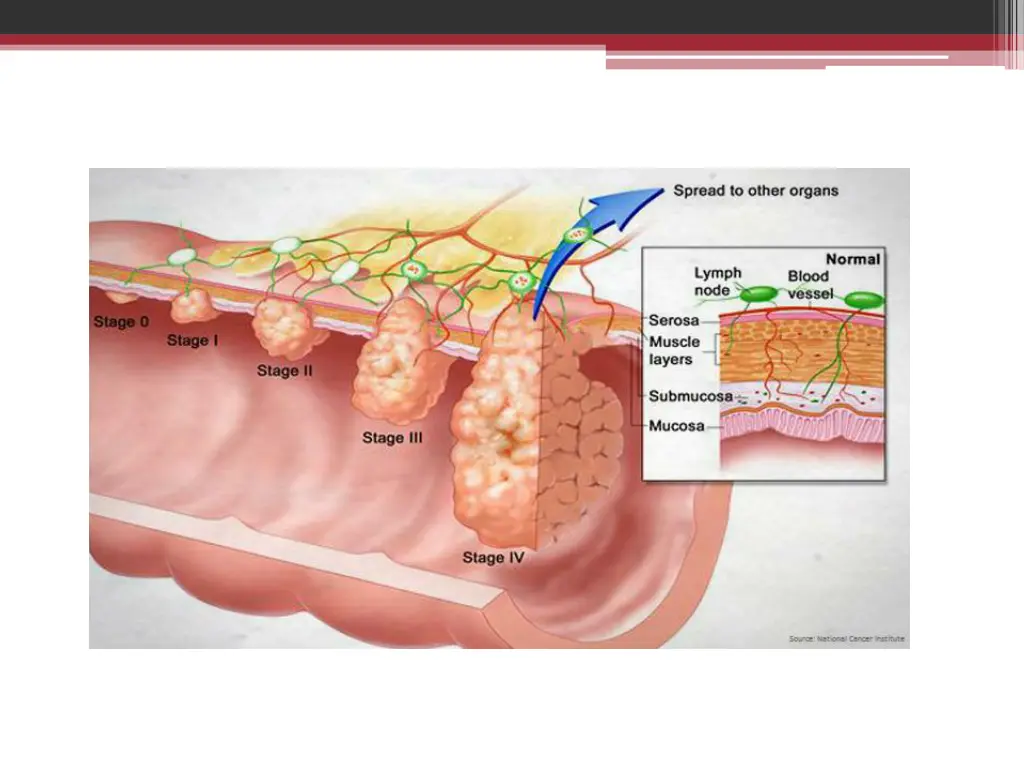 slide5