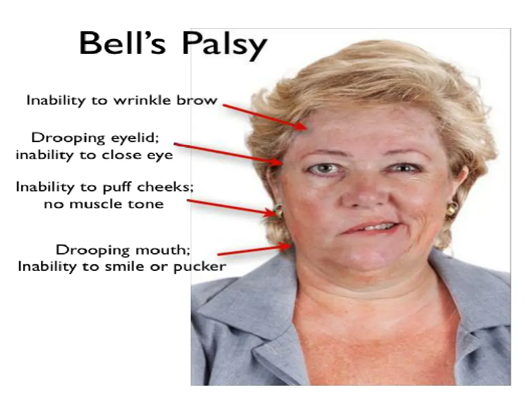 slide20