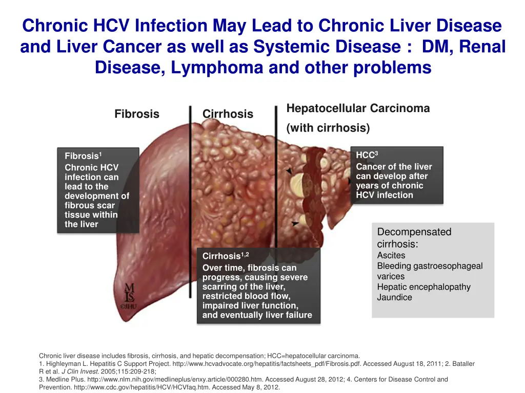 chronic hcv infection may lead to chronic liver