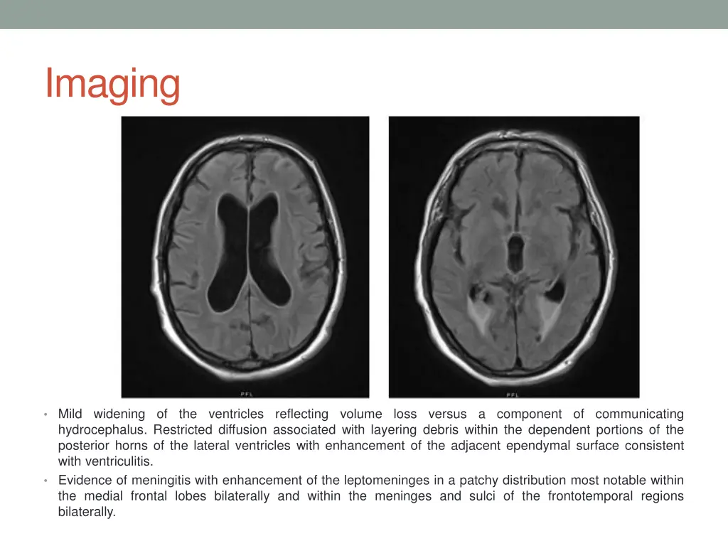 imaging