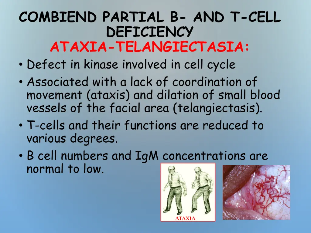 combiend partial b and t cell deficiency ataxia