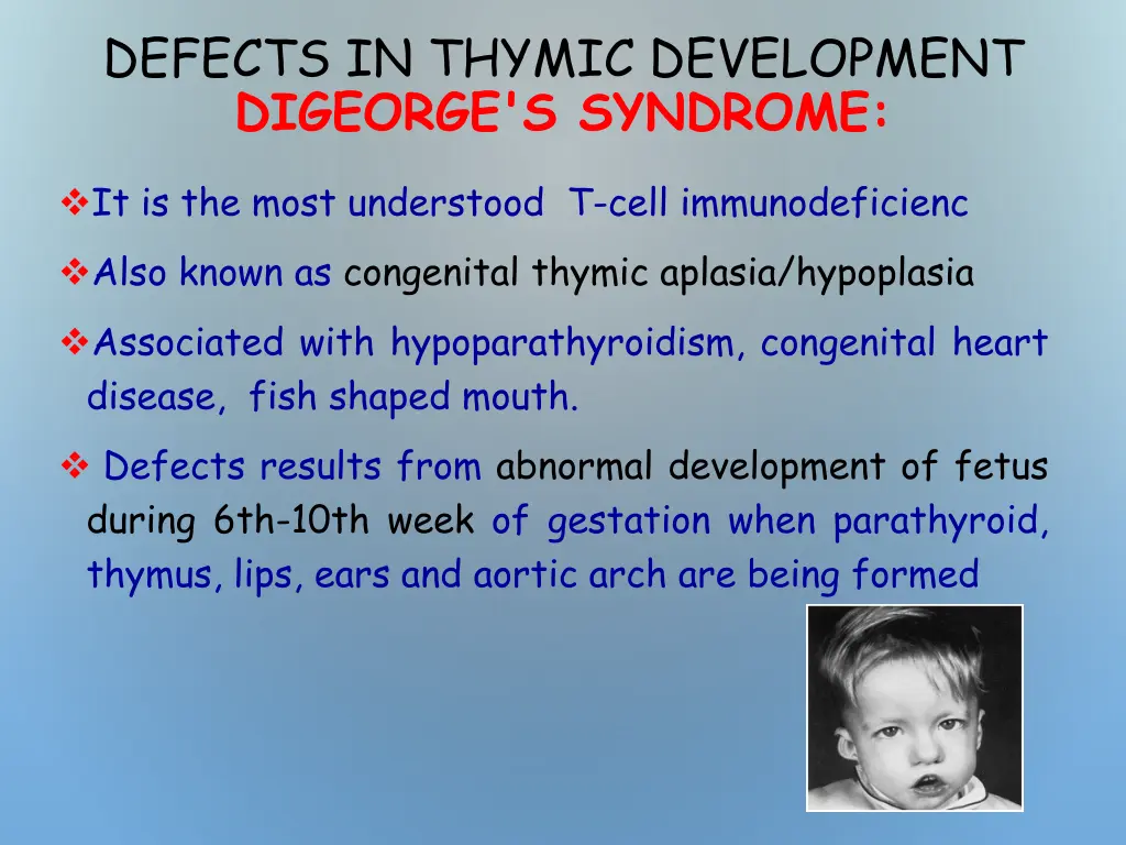 defects in thymic development digeorge s syndrome