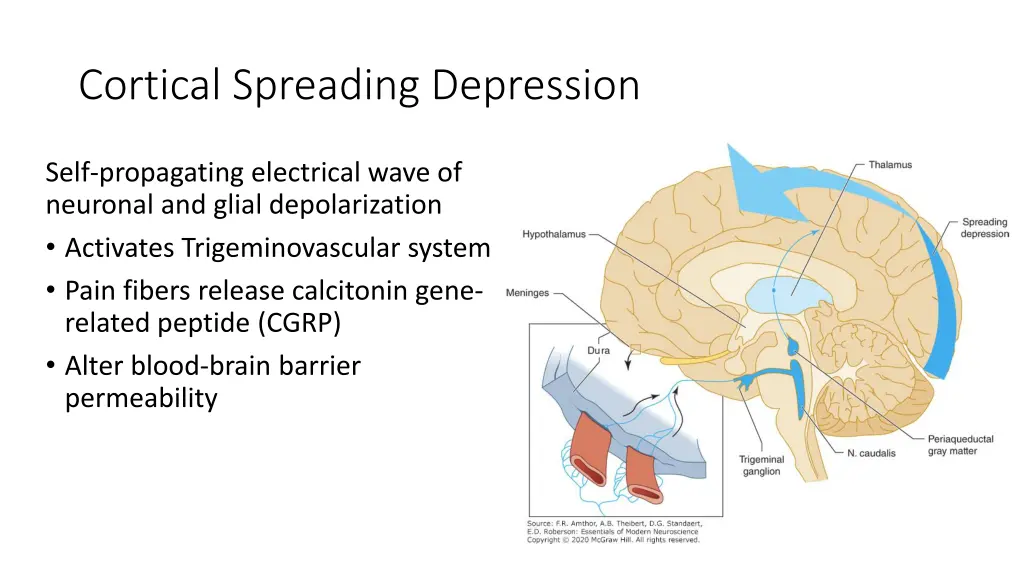 cortical spreading depression