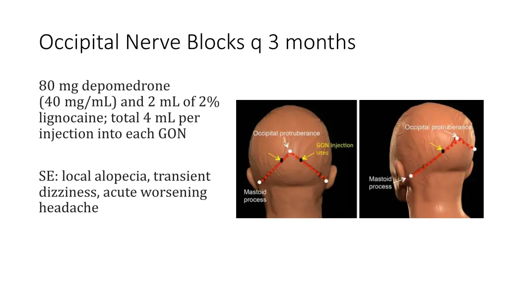 occipital nerve blocks q 3 months