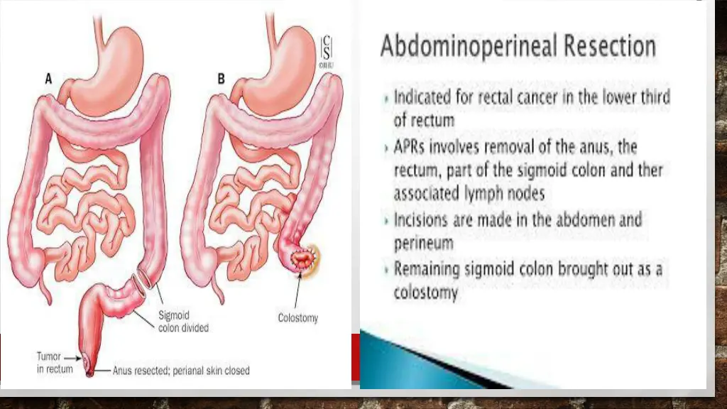 slide26