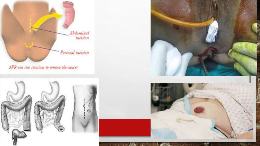 slide27