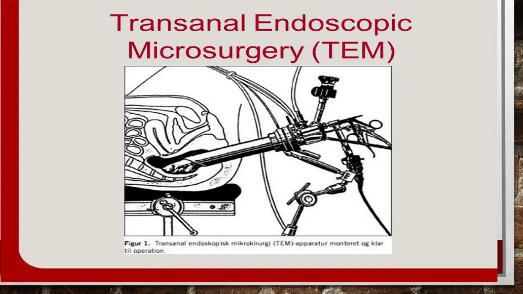 slide29
