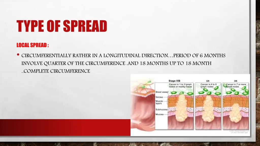 type of spread
