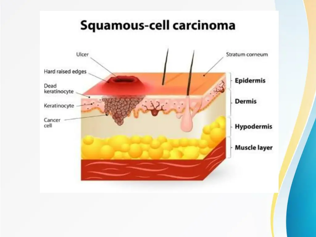 slide20