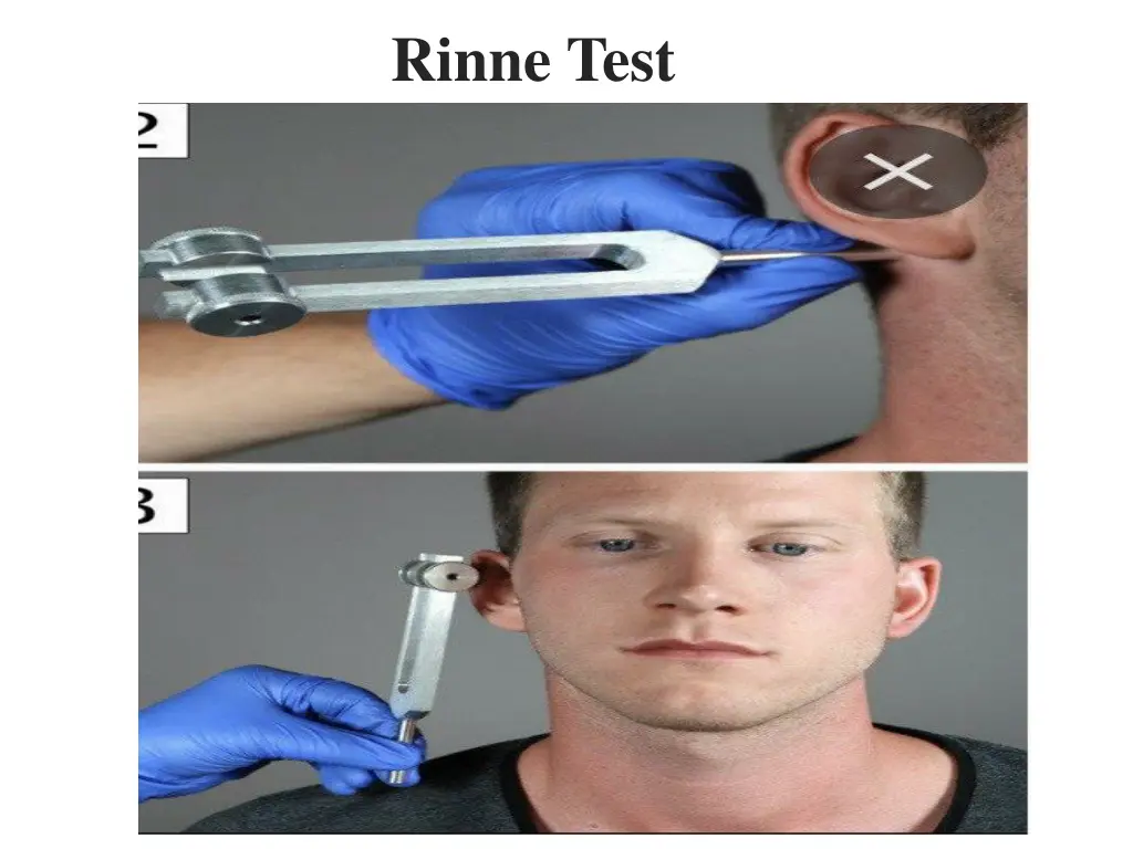 rinne test 1