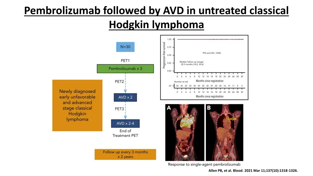 pembrolizumab followed by avd in untreated