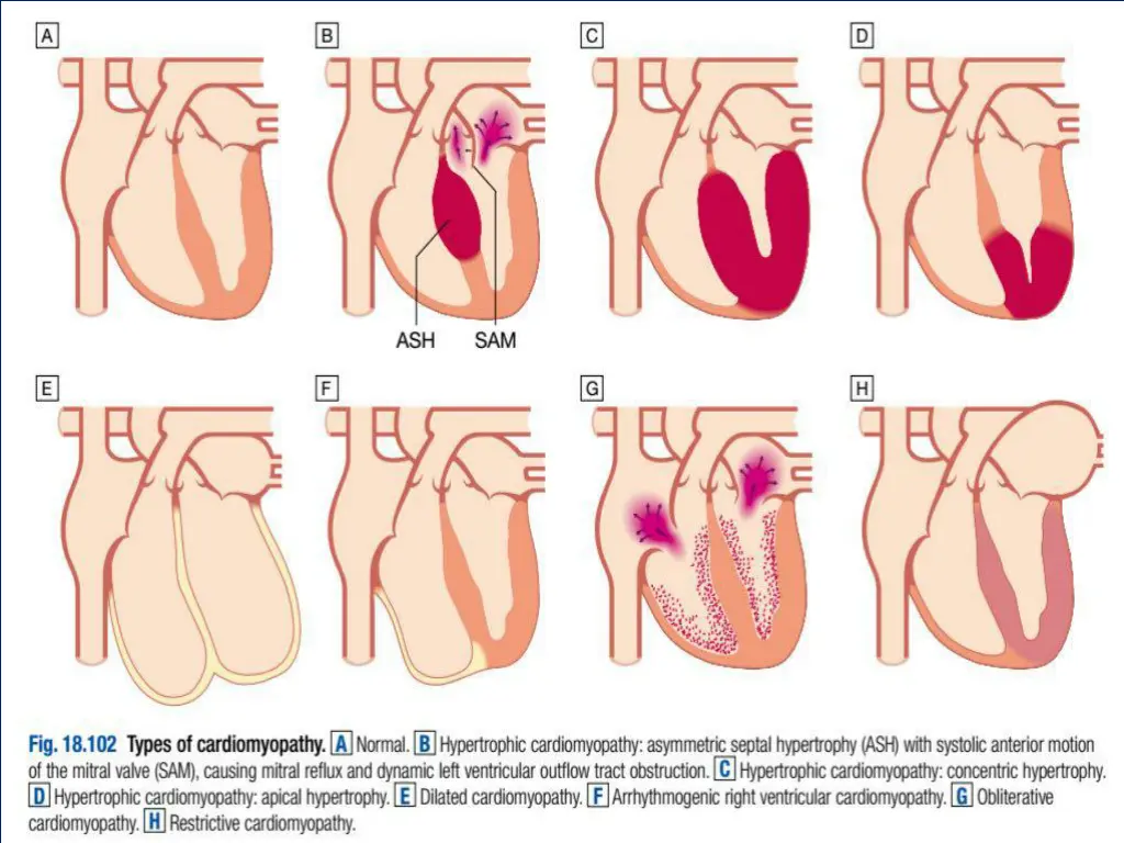 slide15