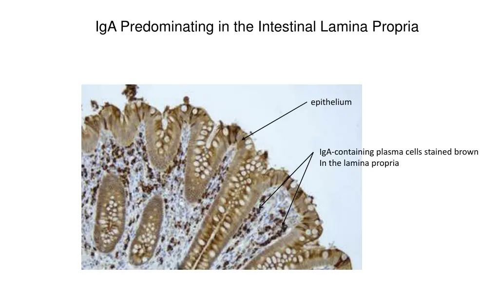 iga predominating in the intestinal lamina propria