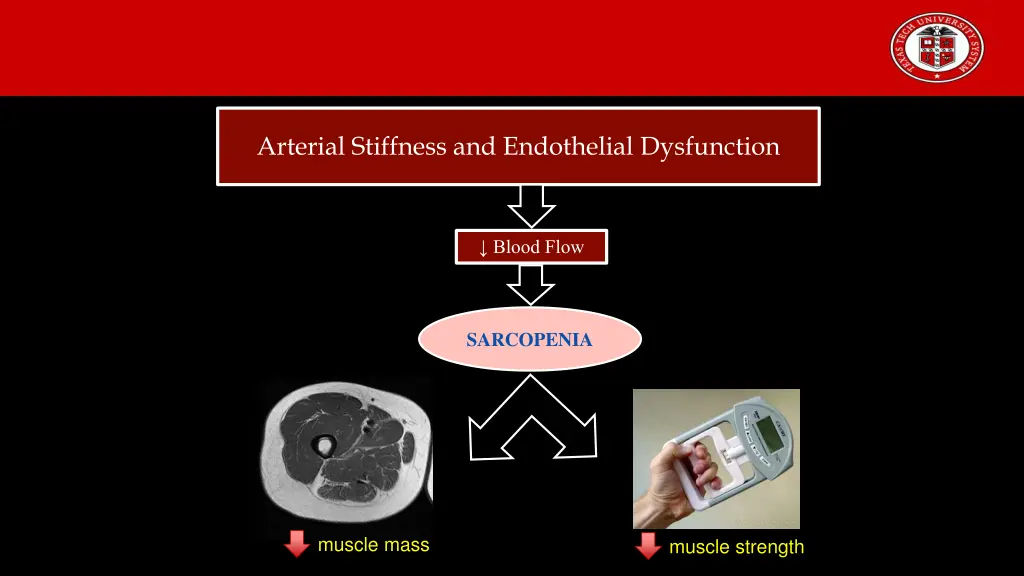 arterial stiffness and endothelial dysfunction
