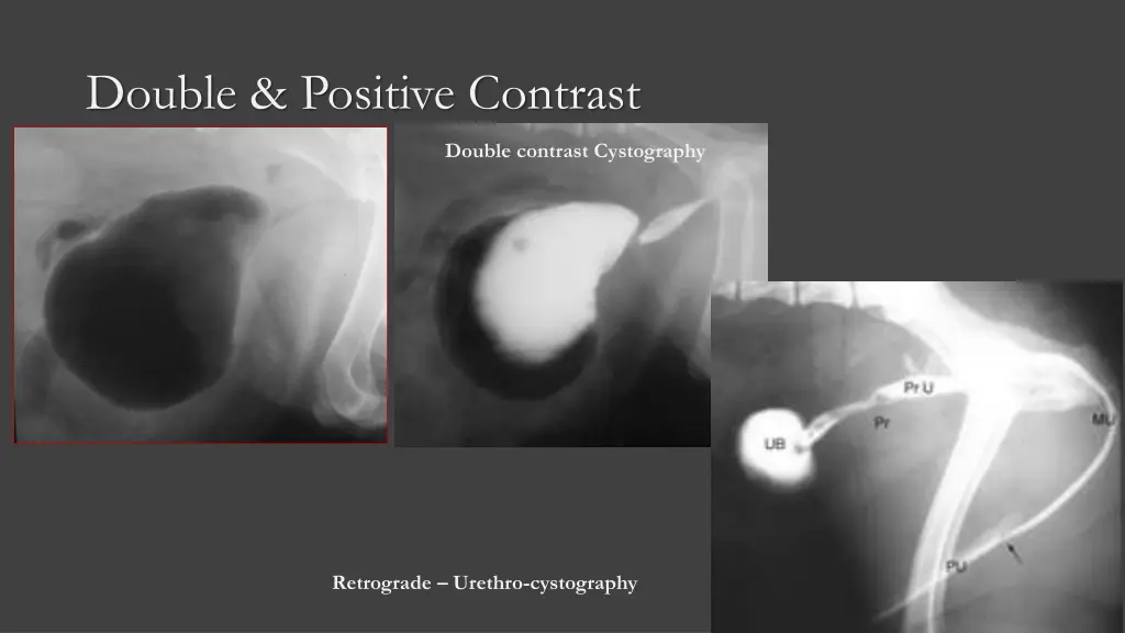 double positive contrast