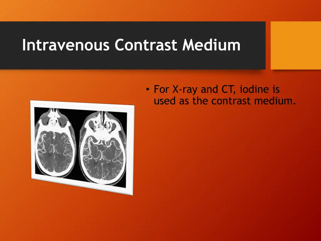 intravenous contrast medium 1