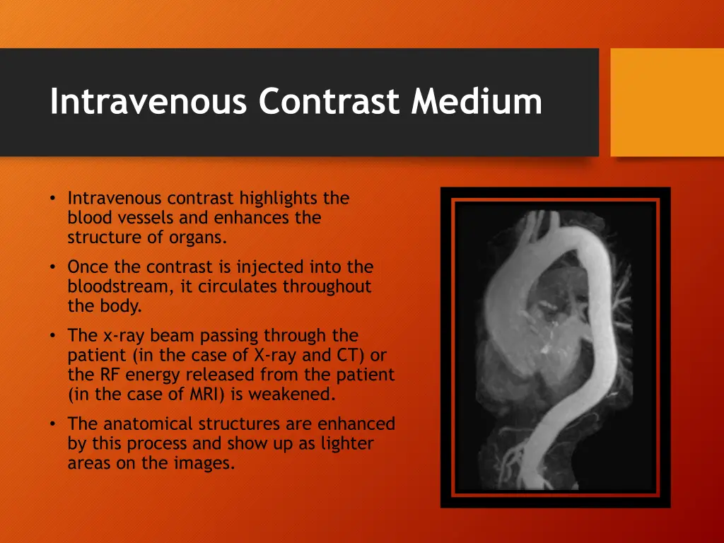 intravenous contrast medium