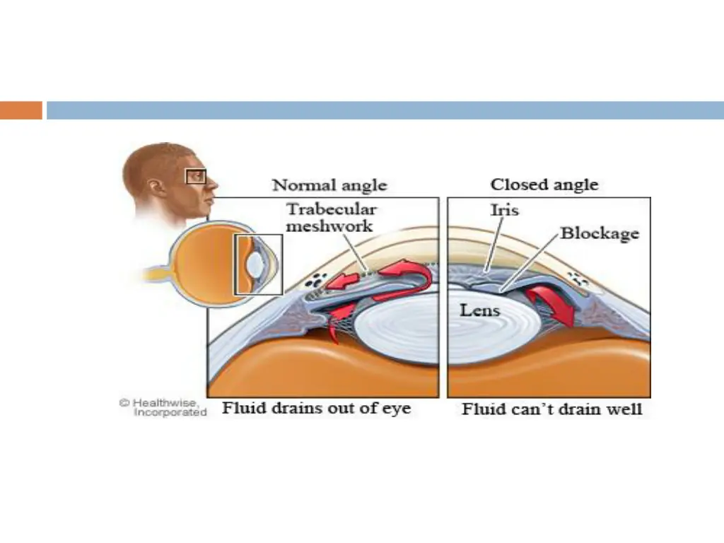 slide25