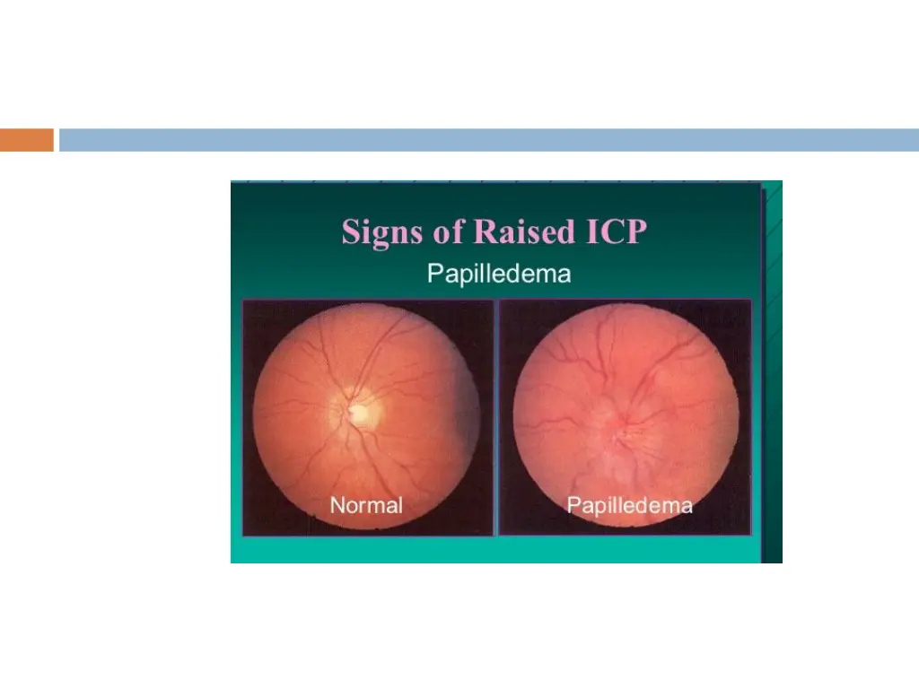 slide6