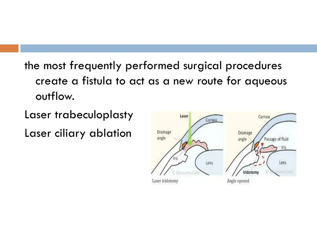 the most frequently performed surgical procedures