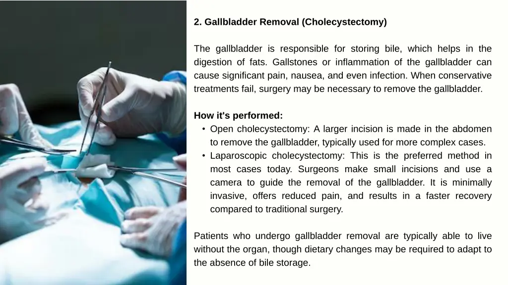 2 gallbladder removal cholecystectomy