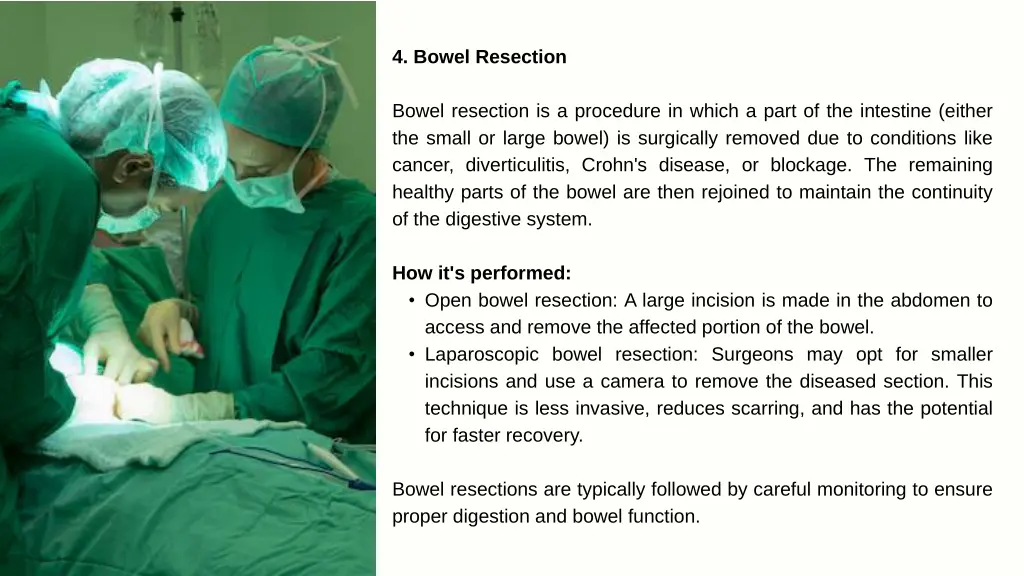 4 bowel resection