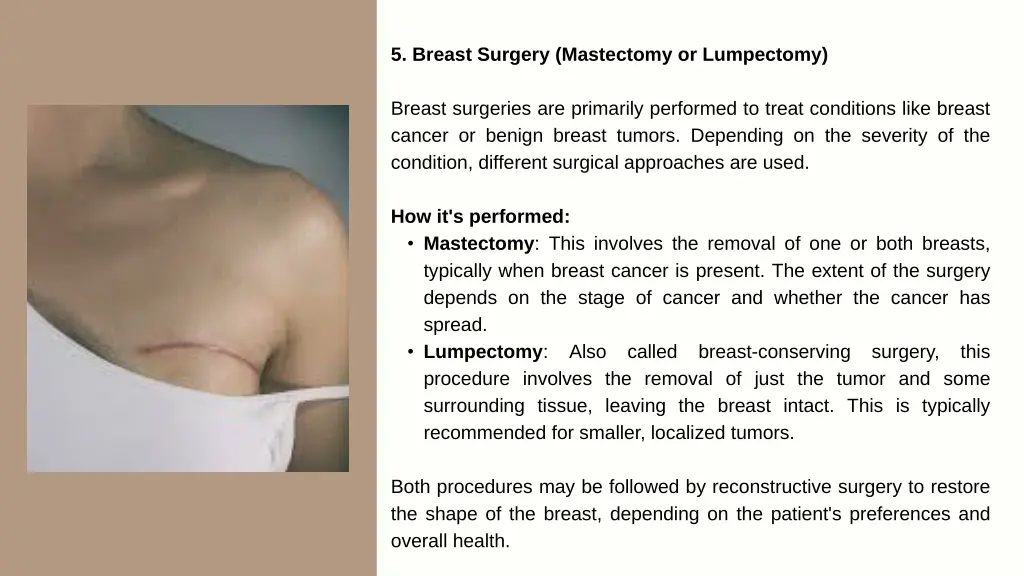 5 breast surgery mastectomy or lumpectomy