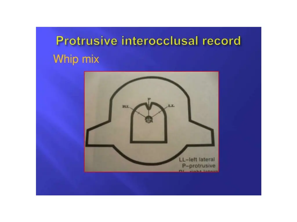 slide26