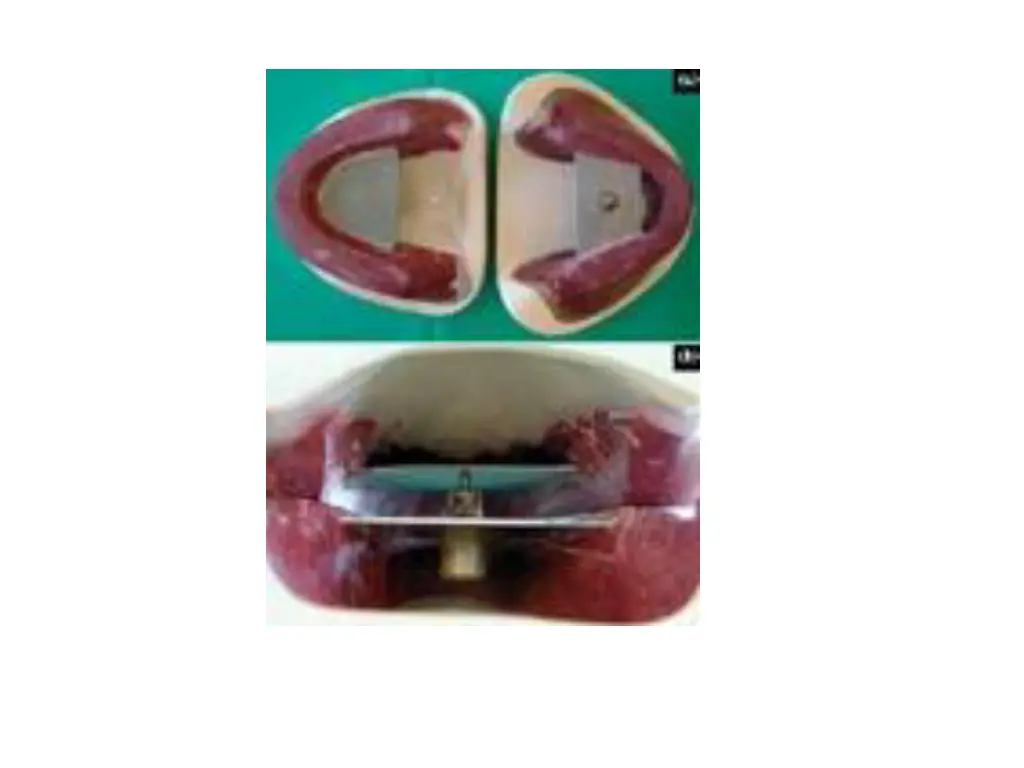 slide28