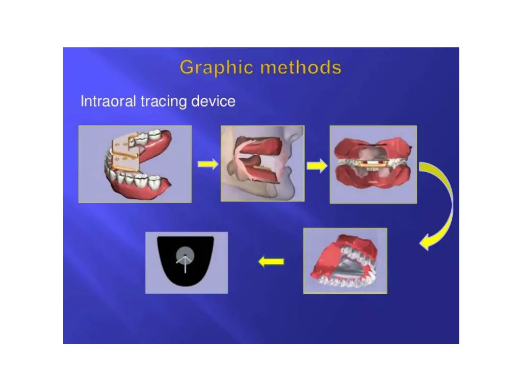 slide30