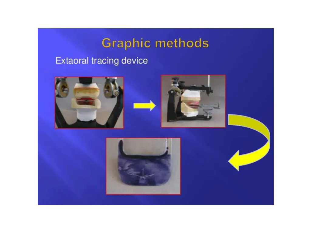 slide33