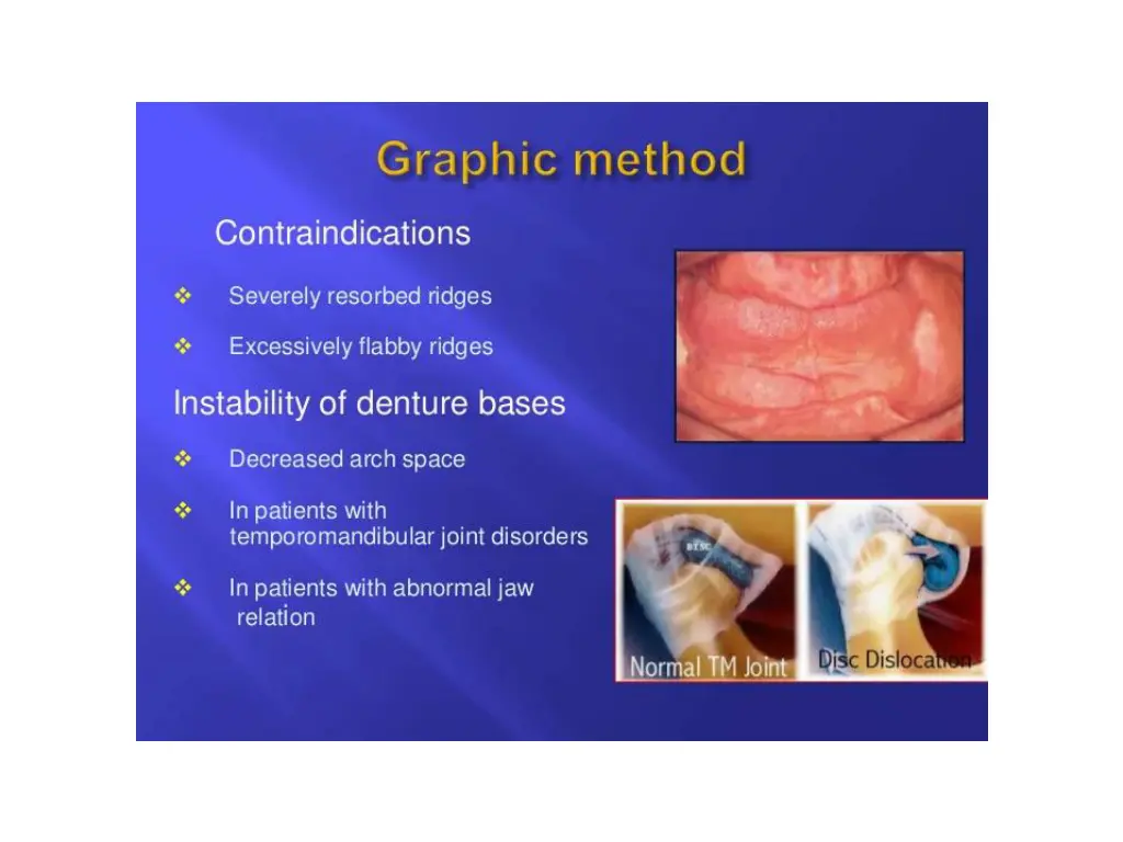 slide34