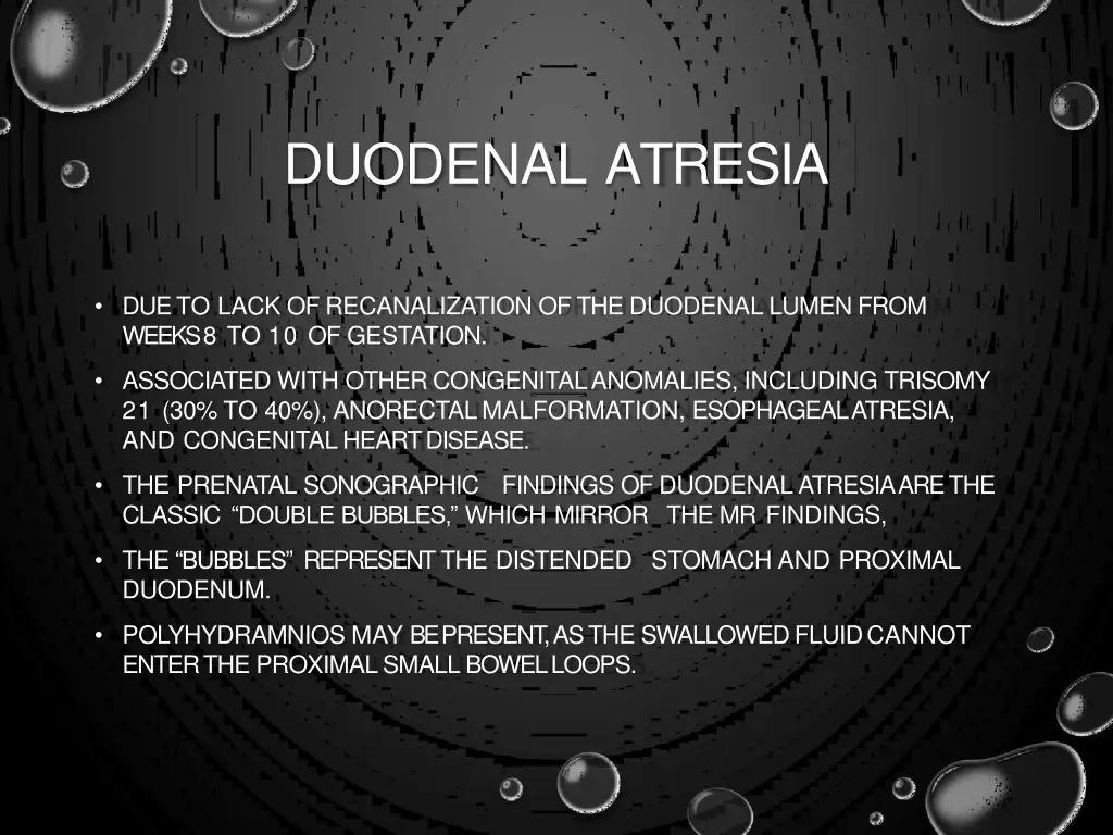 duodenal atresia