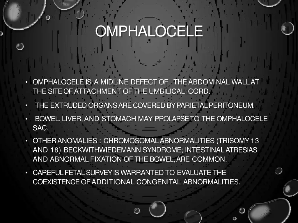 omphalocele