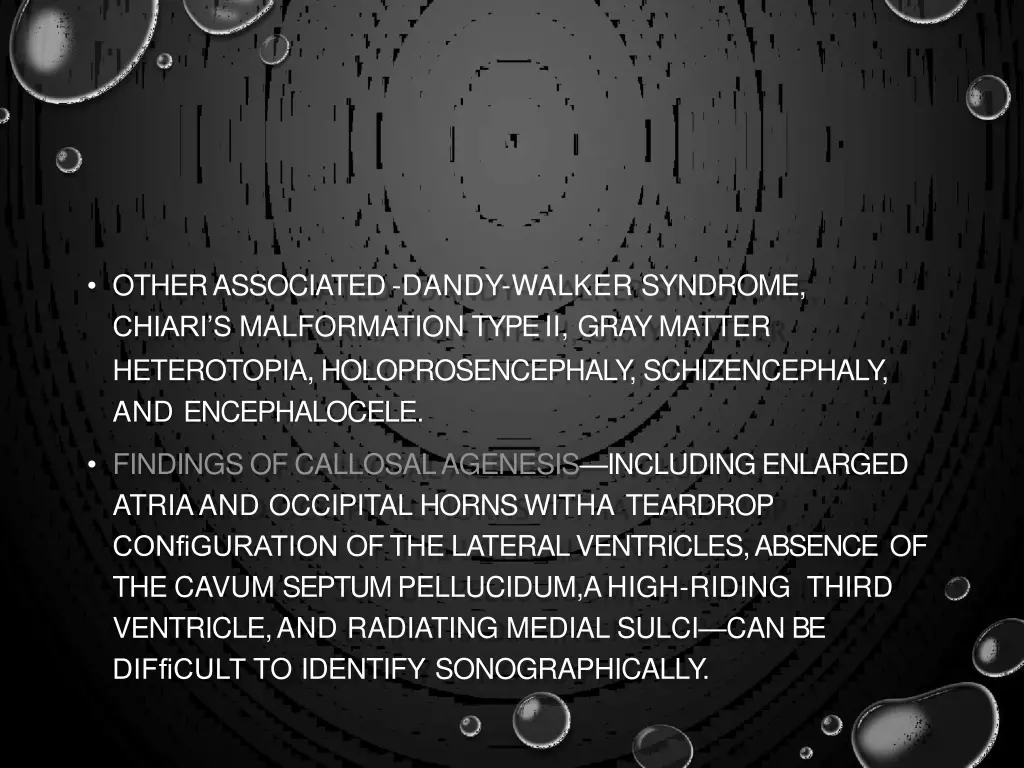 other associated dandy walker syndrome chiari