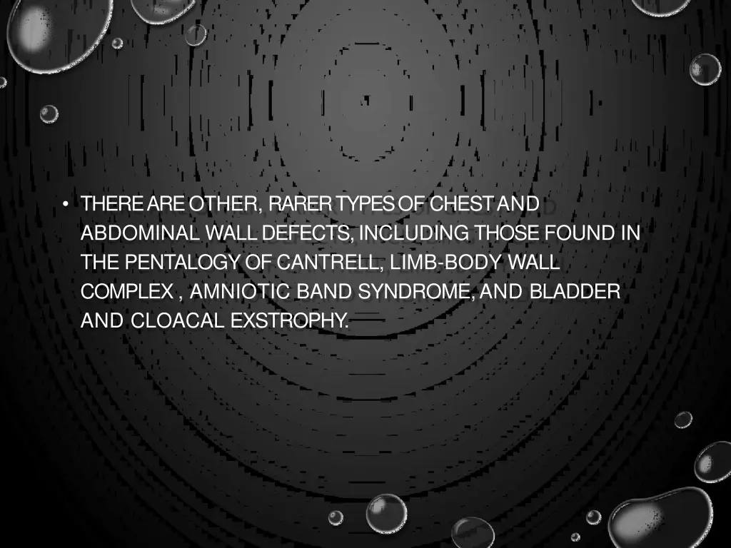 there are other rarer types of chest