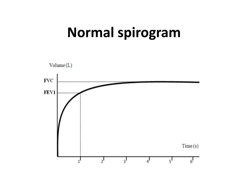 normal spirogram