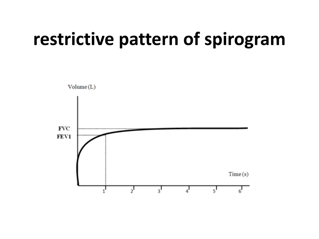 restrictive pattern of spirogram