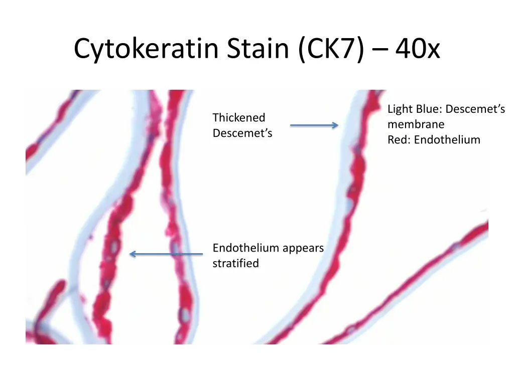 cytokeratin stain ck7 40x