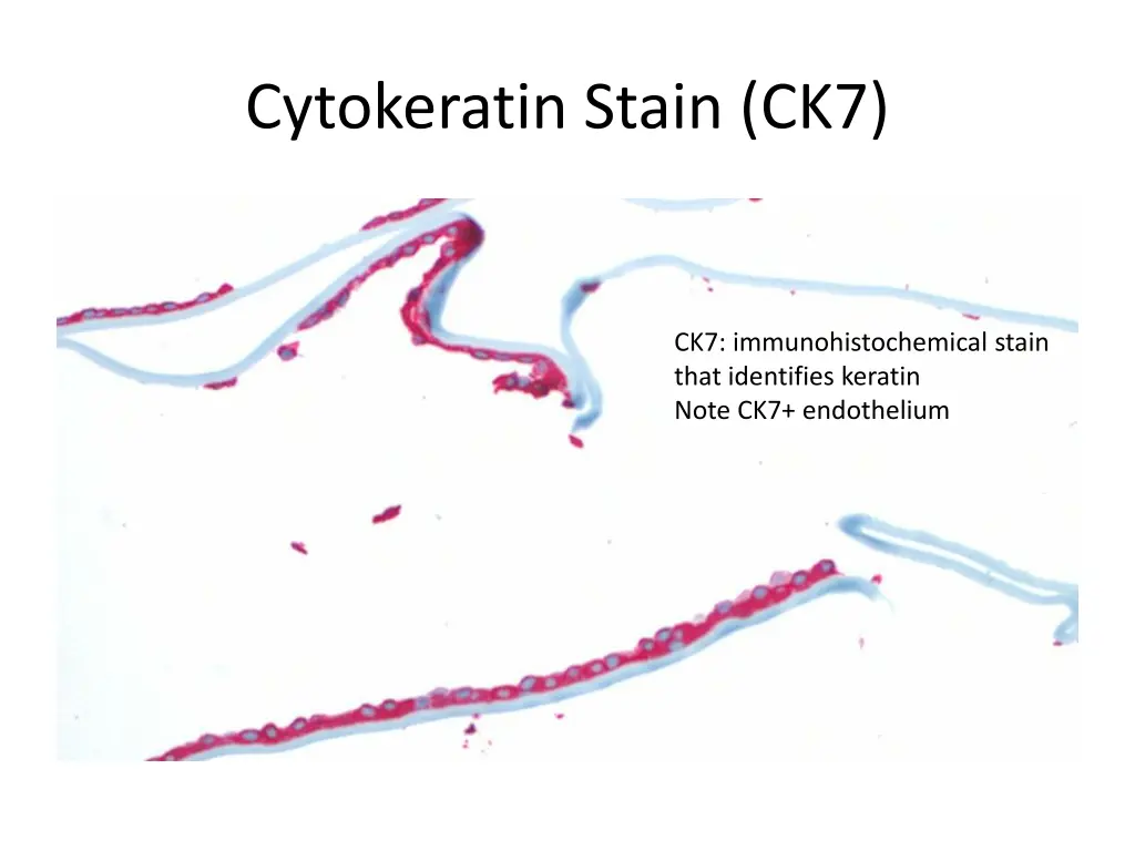 cytokeratin stain ck7