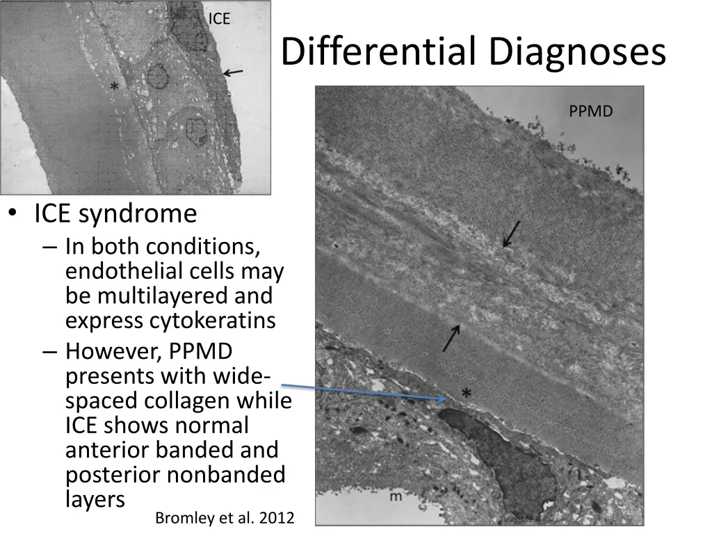 slide11