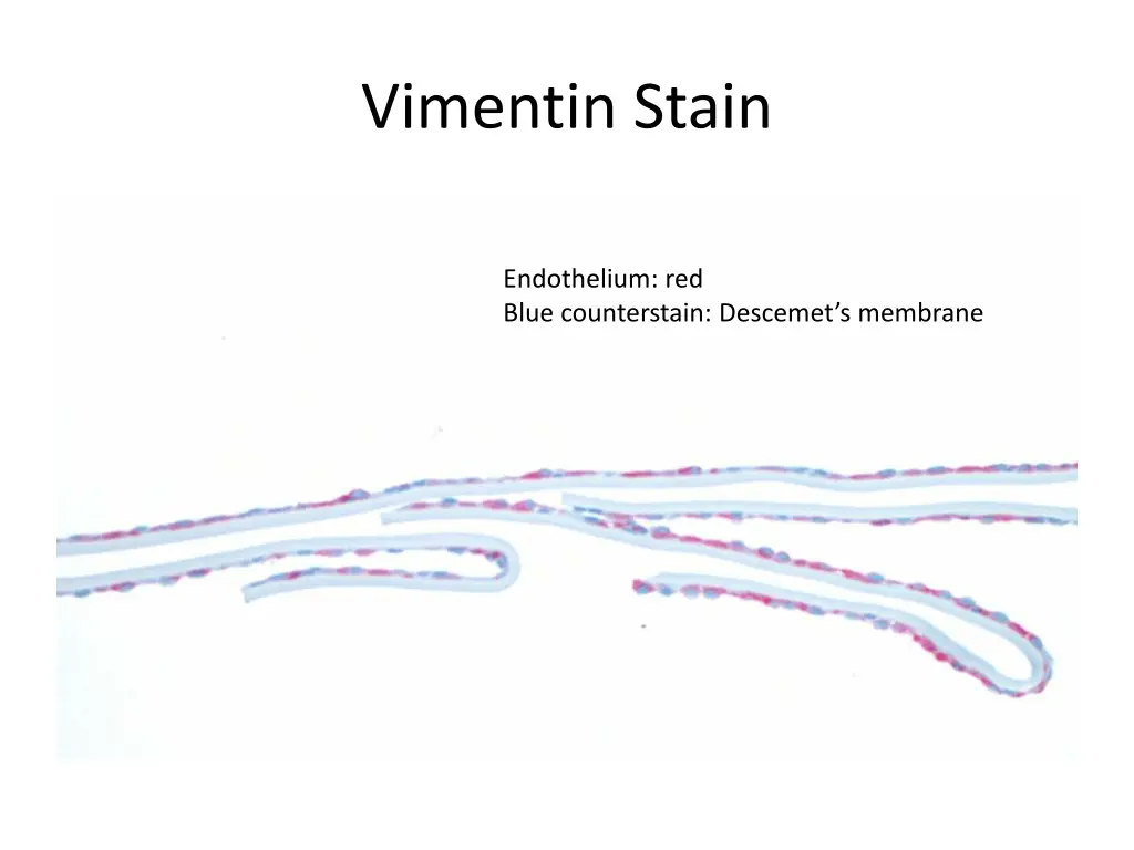 vimentin stain