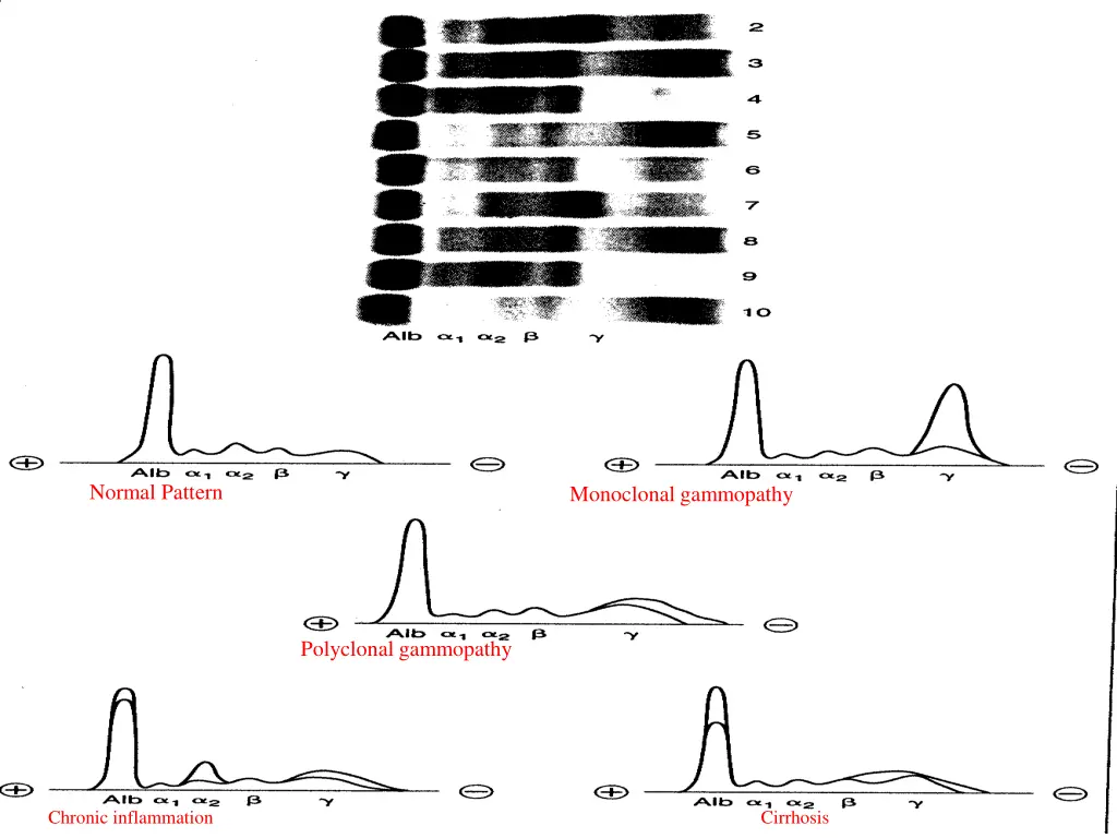 normal pattern