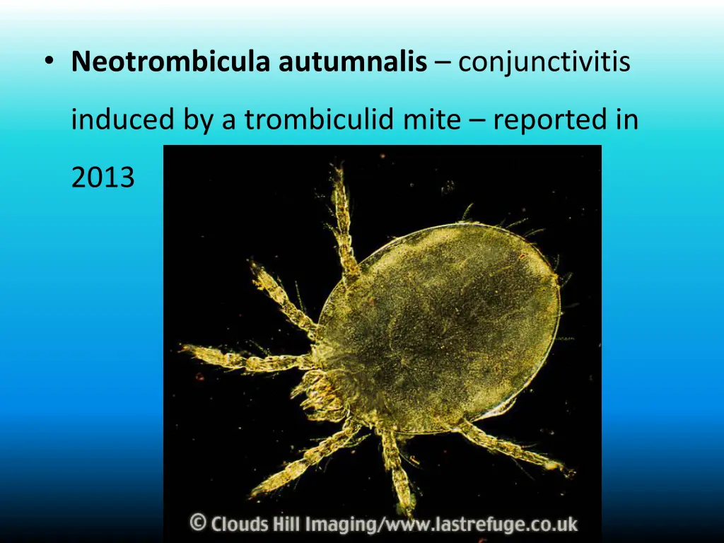 neotrombicula autumnalis conjunctivitis